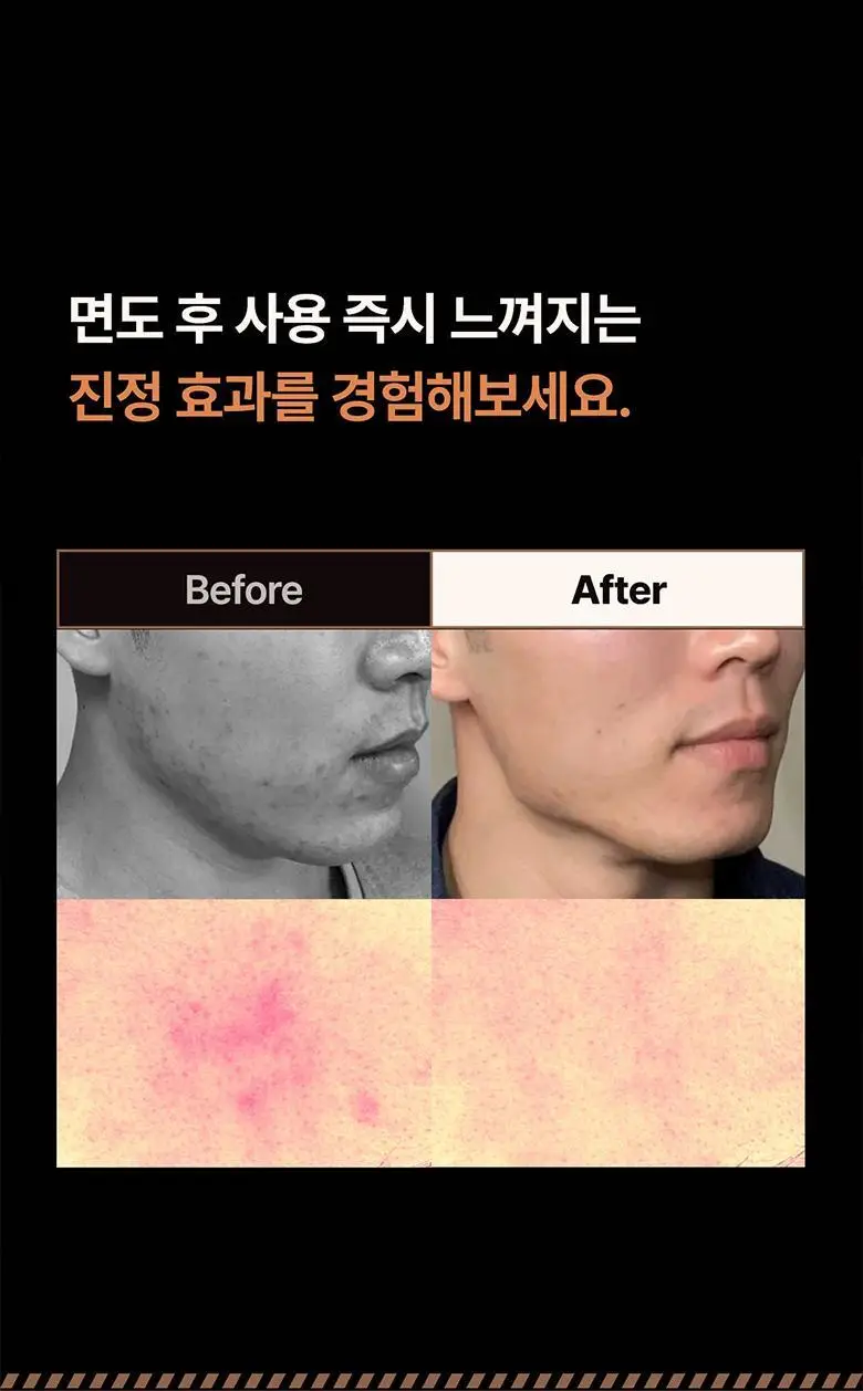 [피부진정/애프터쉐이브] 헤레카 알럼스틱 60g 상세페이지 5